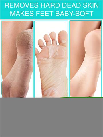 Foot Peel Mask Miami